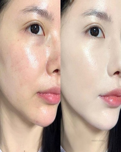 Skin Glow